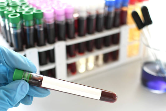 Blood Samples for Blood Type Testing in a Laboratory
