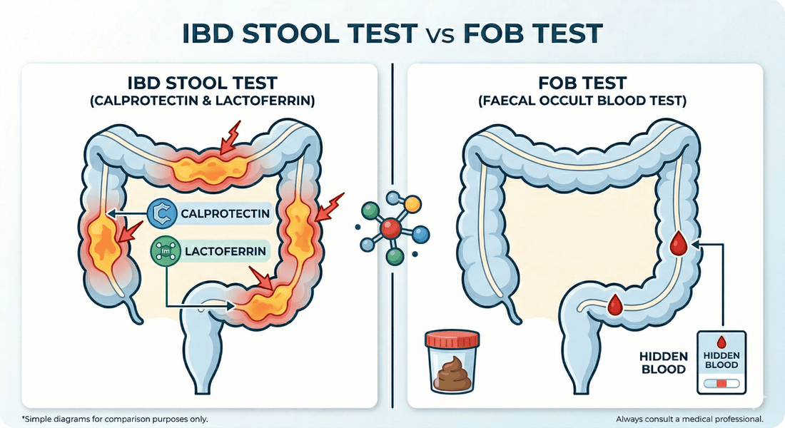 What’s the difference between an IBD stool test and an FOB test?