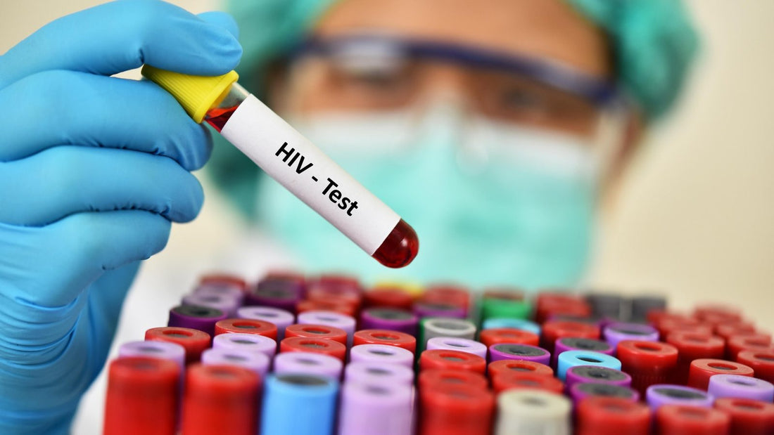 HIV testing after exposure: Window periods, accuracy and what to do while you wait